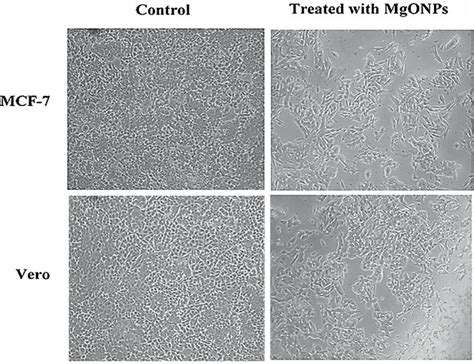 In vitro cytotoxicity of MgONPs on breast cancer cell line, MCF‐7, and ...