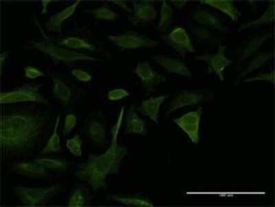 Collagen V Alpha 2 Antibody 3G11 H00001290 M02 Novus Biologicals