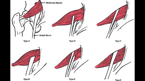 The Sciatic Nerve Anatomy Origin Course Branches Relations