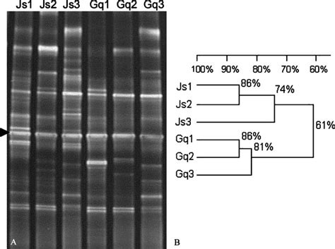 A Denaturing Gradient Gel Electrophoresis Dgge Profile Of Pcr Download Scientific Diagram