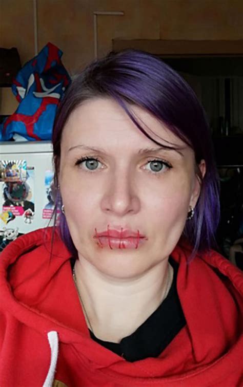 Russian Woman Sews Her Mouth Shut In Protest Of Putin