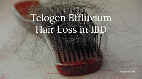 Telogen Effluvium Hair Loss In Ibd • Dan Sharp