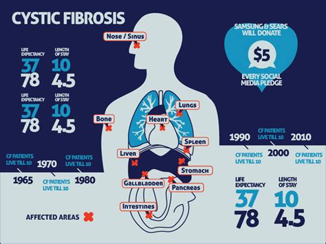 Tackle Cystic Fibrosis Jess3