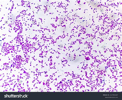 Gram Stain E Coli