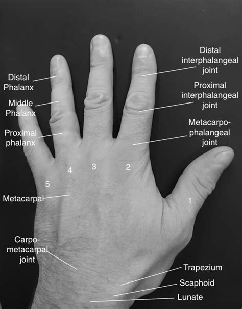 Common Hand And Wrist Injuries In Striking Sports Part 1 The Hot Sex Picture