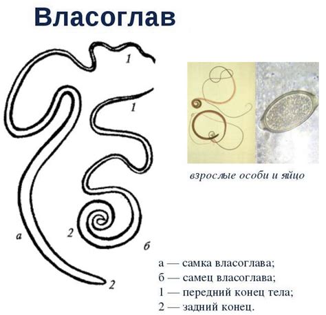Как выглядят глисты в кале у человека фото