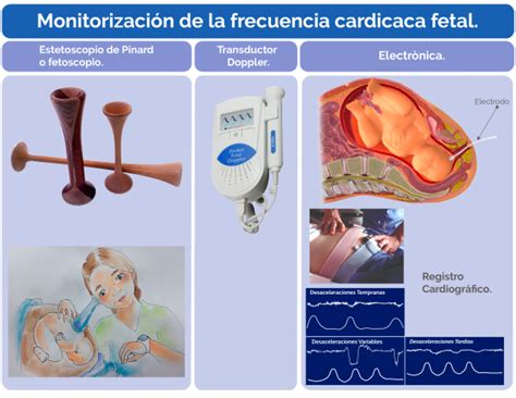 Unidad Did Ctica Aplicaci N Del Proceso De Enfermer A A La Mujer