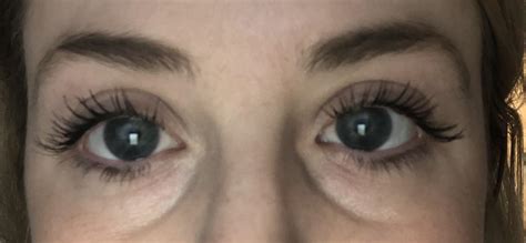 33F Any Non Surgical Recs For Under Eye R 30PlusSkinCare