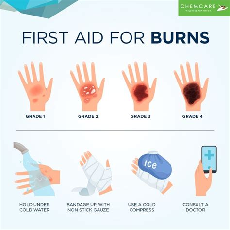 Burn First Aid Contact With Any Source Of Heat Can Cause A Burn Or