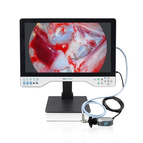 Endoscope Camera Tu Lsd B Shenzhen Tuyou Medical Imaging