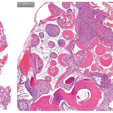 A The Core Biopsy With H E Stain B The Newly Generated Bone Was