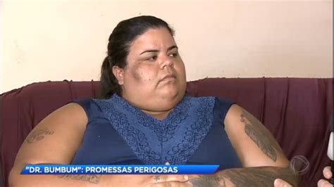 Paciente Do Dr Bumbum Revela Promessas Perigosas Do Médico