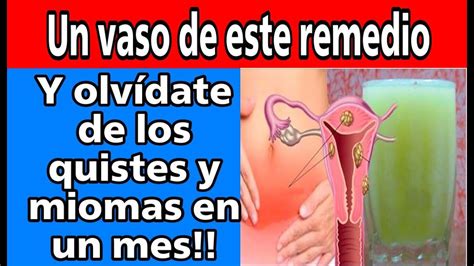 Un Vaso De Este Remedio Y Olv Date De Los Miomas Y Quistes Uterinos En