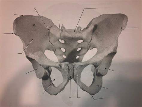 Articulated Pelvic Girdle [composed Of Right And Left Os Coxae And Sacrum