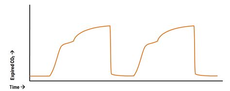 End Tidal Capnometry Waveform Interpretation Deranged Physiology