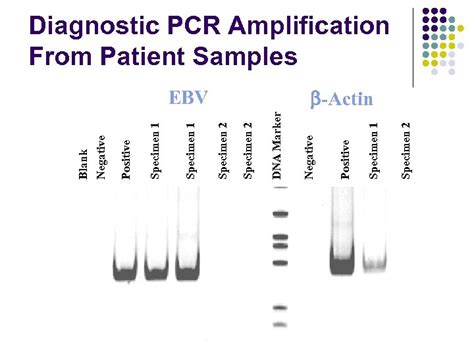 Chapter Nucleic Acid Amplification Techniques Donna C