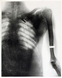 10 Hot Sexy Elizabeta Fleischmann Bikini Pics