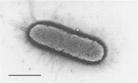 Salmonella Enterica Micrograph - img-omnom