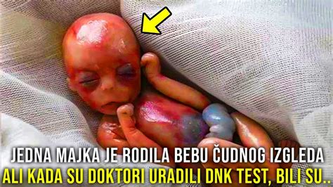 Rodila Je Bebu Udnog Izgleda Ali Kada Su Doktori Uradili Dnk Test