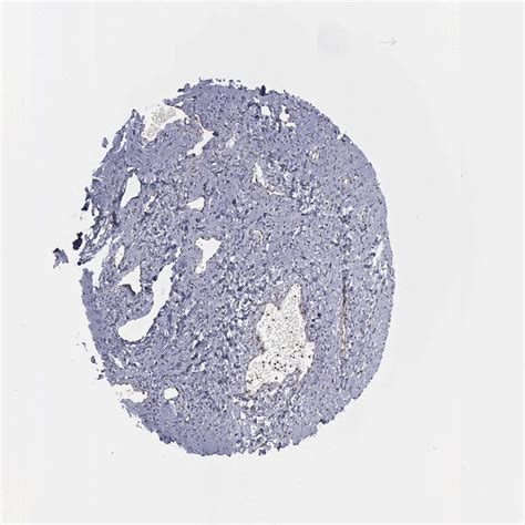 Tissue Expression Of Atm Staining In Cervix The Human Protein Atlas