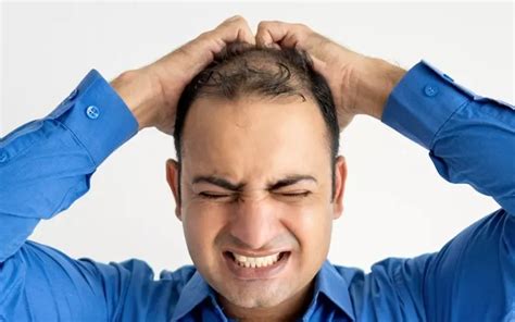 What Are The Main Causes Of Hair Loss In Men