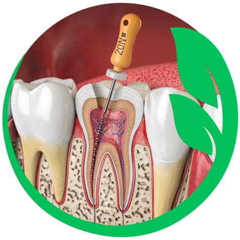 Root Canal Therapy With A Holistic Approach 🌱 Integrative Dental Care