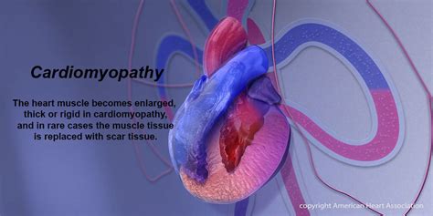 Genetic Testing For Heart Diseases May Help Patients And Families