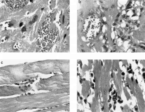 Inflammatory Response In Hearts Of Balb C Nu Nu Mice Inoculated With