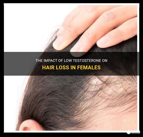 The Impact Of Low Testosterone On Hair Loss In Females Medshun