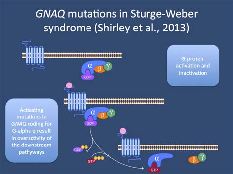 Sturge Weber Syndrome Explained Somatic Mutations In Gnaq Beyond