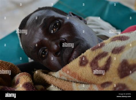 June 28 2017 Juba Jubek South Sudan A Man Lays On Bed Recovering From A Severe Case Of