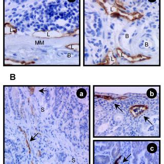 Immunohistochemical Staining Of Lymphatic Vessels By The Lyve