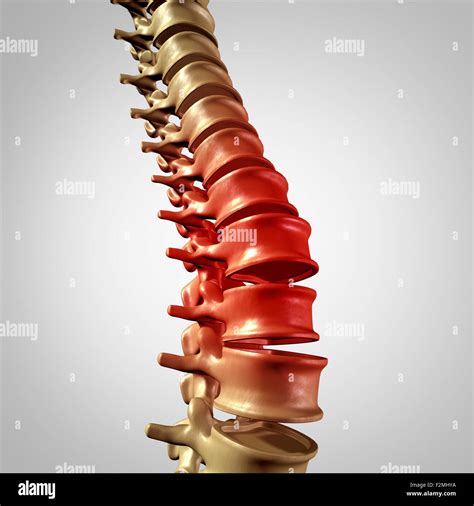 La Columna Vertebral Y Dolor En La Parte Baja De La Espalda De La