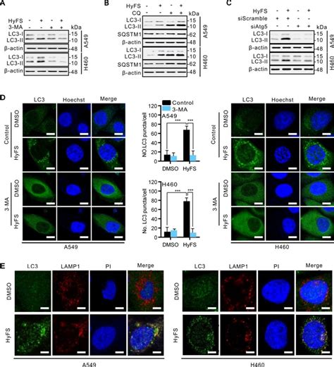 Hyfs Induces Autophagy Flux In Lung Cancer Cells A A549 And H460