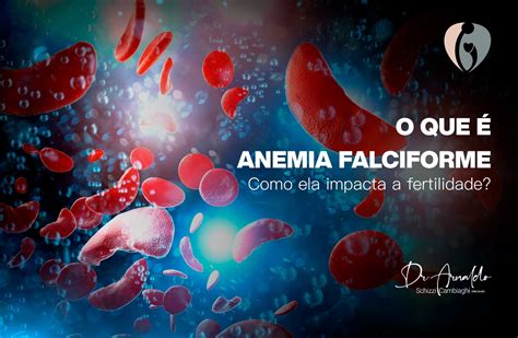 O QUE É A ANEMIA FALCIFORME E QUAL SEU IMPACTO NA FERTILIDADE IPGO