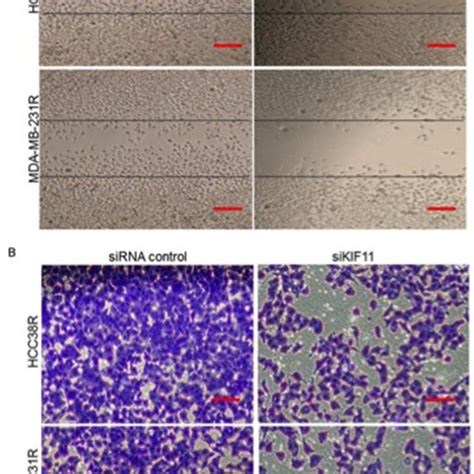 Knockdown Of Kif Inhibits Migration And Invasion Of Resistant Tnbc