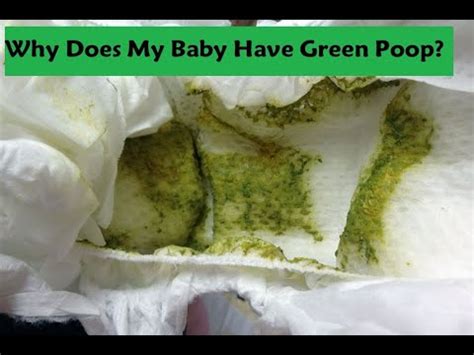 Green Poop Infant Breastfed