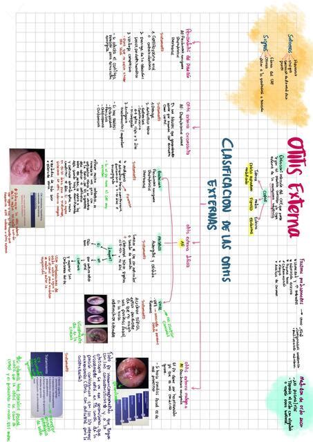 Otitis Externa Daniela Lvarez C Udocz