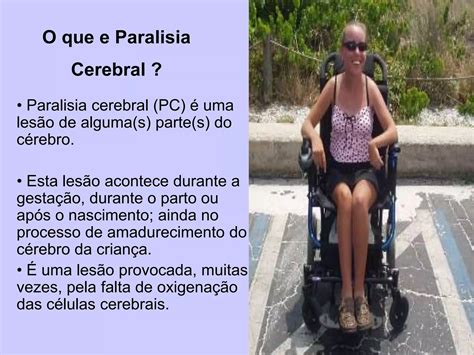 Paralisia Cerebral PPT