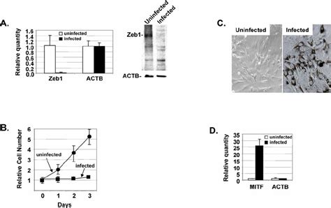shRNA knockdown of Zeb1 prevents proliferation and EMT of RPE cells in ...