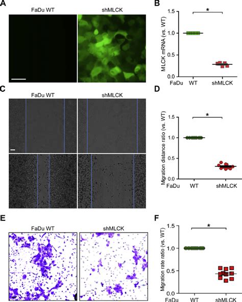 Mlck Expression Is Associated With Cell Migration In Hypopharyngeal