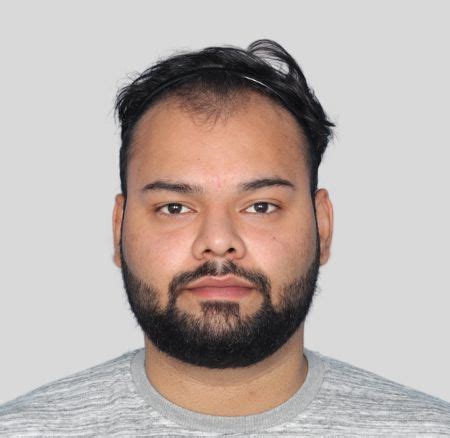 Result Gallery - QHT Clinic - Hair Transplant Service India