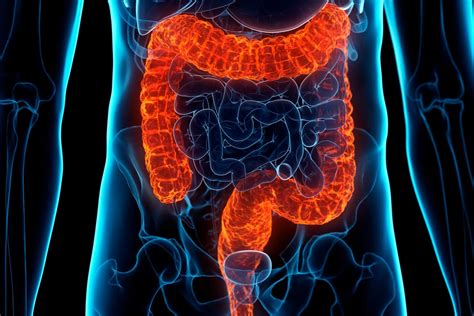 Ulcerative Colitis Symptoms Causes And Treatments The Healthy