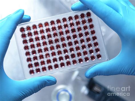 blood screening photograph  tek imagescience photo library pixels