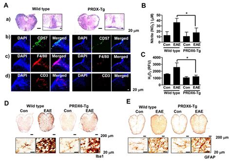 Prdx6 Attenuates Immune Cell Infiltration And Neuroinflammation In Eae Download Scientific