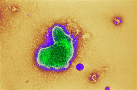 Respiratory Syncytial Virus 2 By Science Photo Library