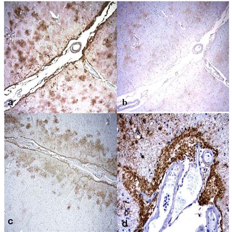 A B Immunolocalization Of Aquaporin 4 Aqp 4 In Areas Of