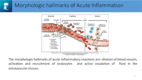 Acute And Chronic Inflammation Flashcards Quizlet