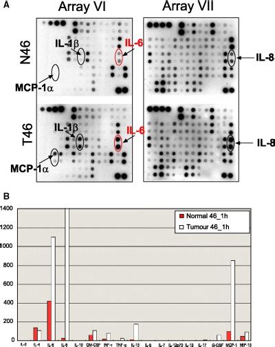 Il 6 Levels In Nif And Tif A Cytokine Specific Antibody Arrays