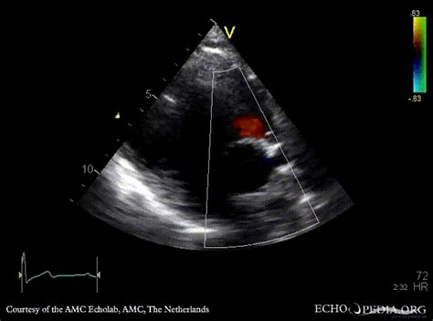 File:E00470.gif - Echopedia